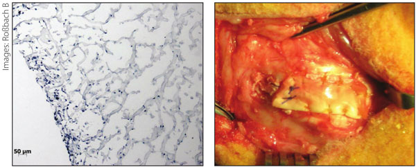 Left: View of a light microscopy of a scaffold (100× magnification) colonized with autologous tenocytes. Right: The researchers implanted the scaffolds in the hind legs of sheep.