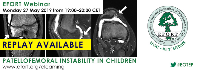 EFORT_Paediatrics_webinar_REPLAY_660x235px