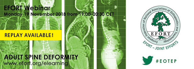 EFORT_webinar_Spine_Replay_660x235px